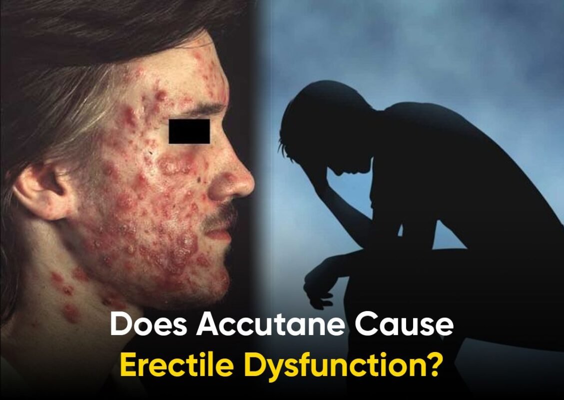 Does Accutane Cause Erectile Dysfunction?