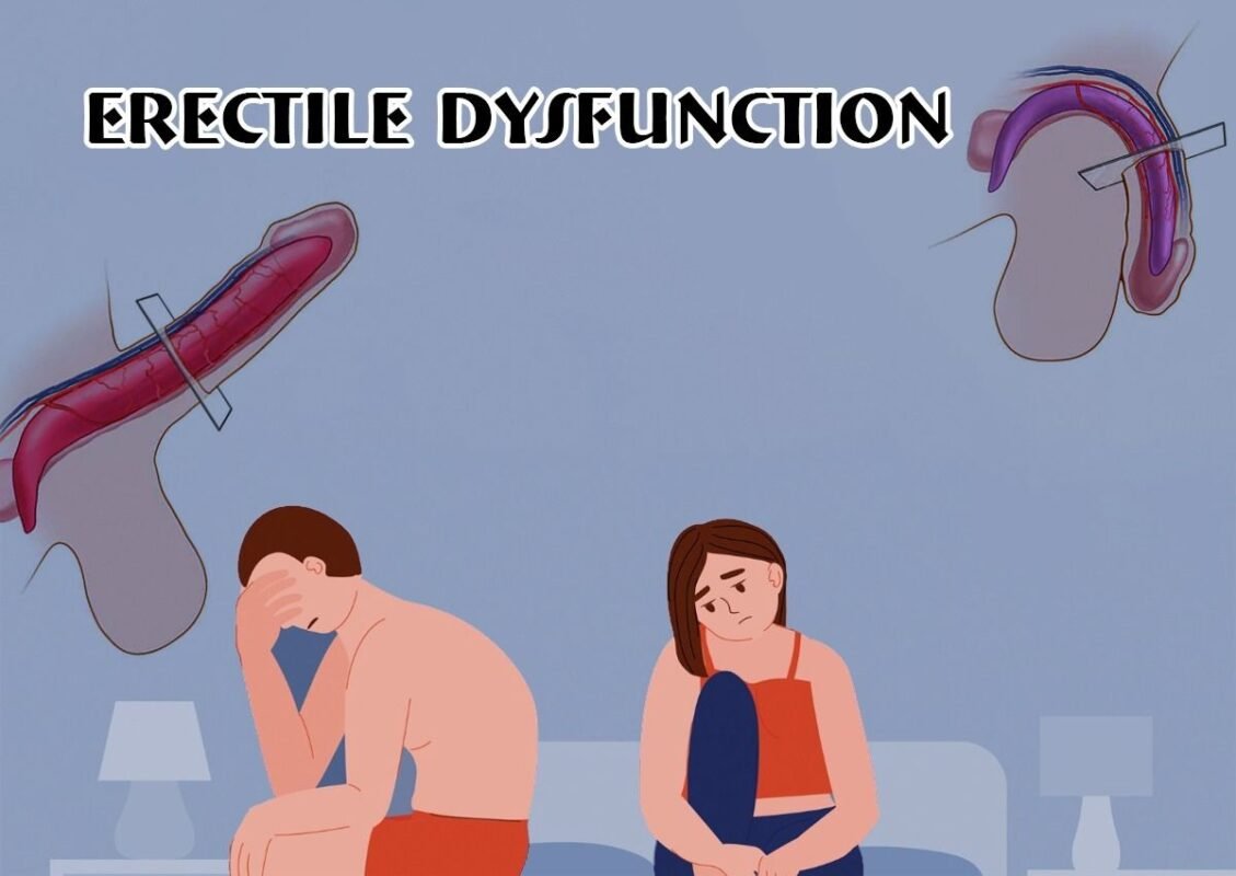 Erectile Dysfunction