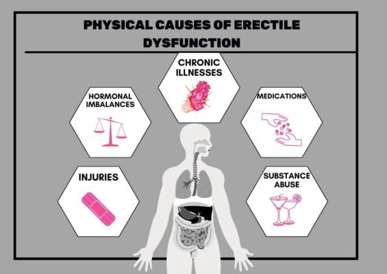 Physical Causes of Erectile Dysfunction