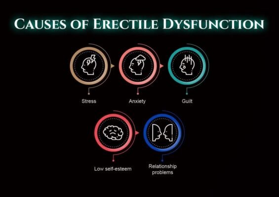 Psychological Causes of Erectile Dysfunction